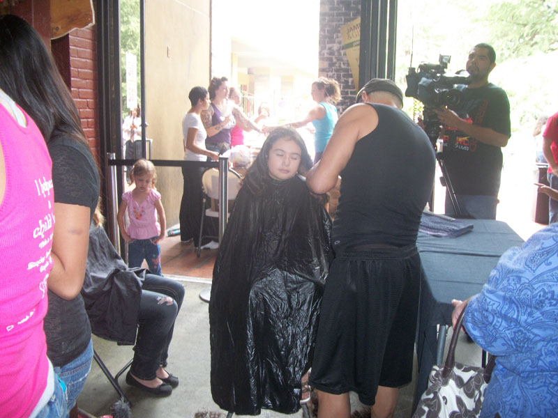 Children with Hairloss03