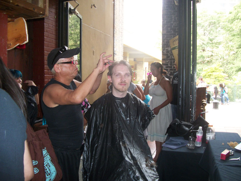 Children with Hairloss14
