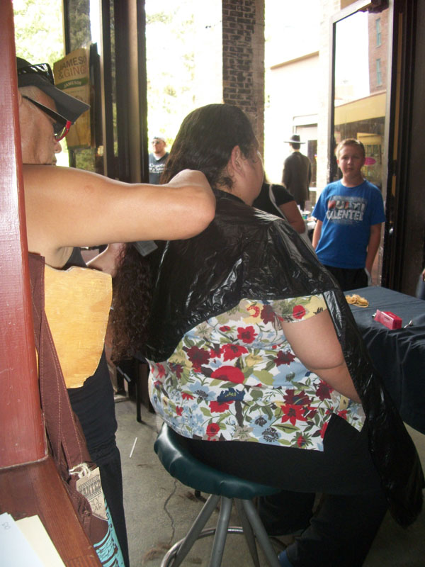 Children with Hairloss19
