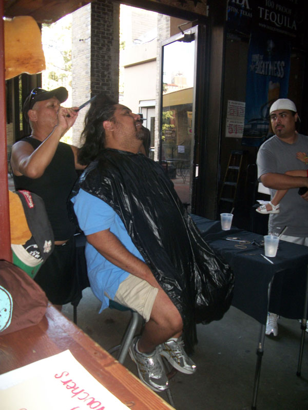 Children with Hairloss35