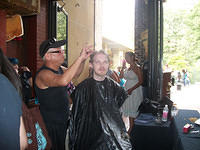 Children with Hairloss14